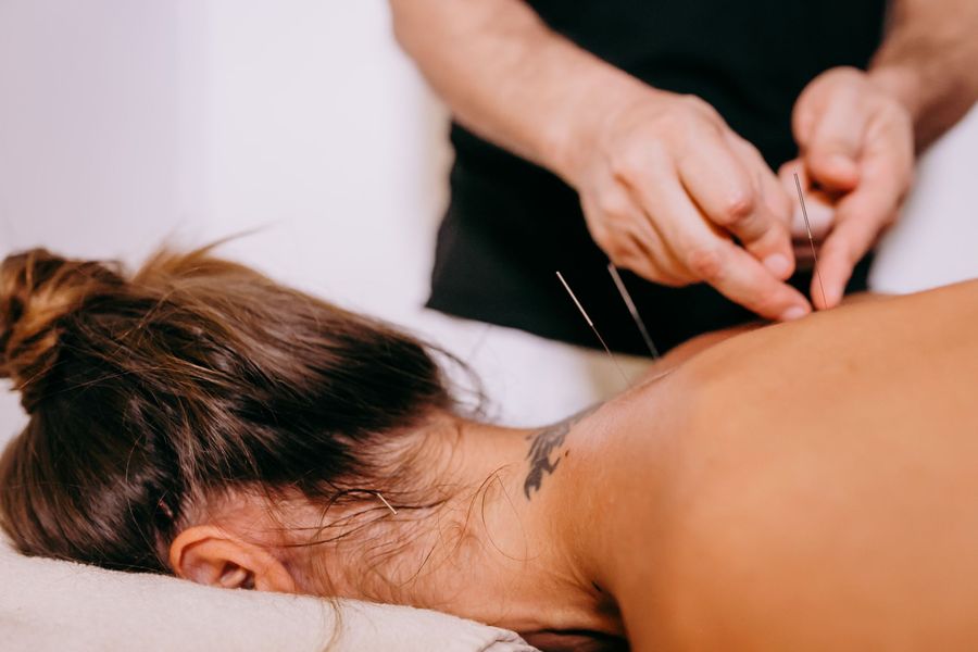 Terapeuta colocando agujas de acupuntura en la espalda