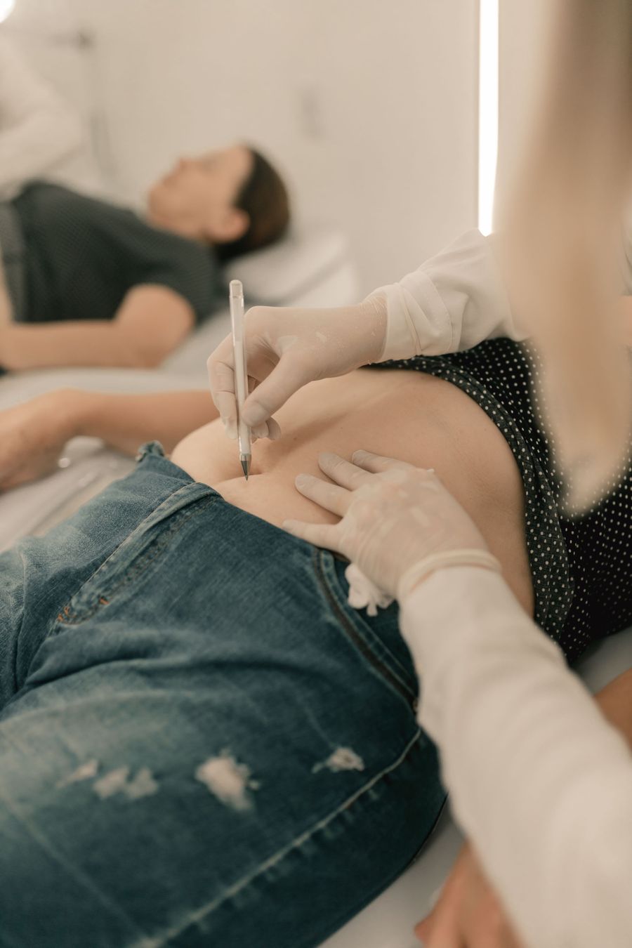 Aplicación de carboxiterapia en el abdomen