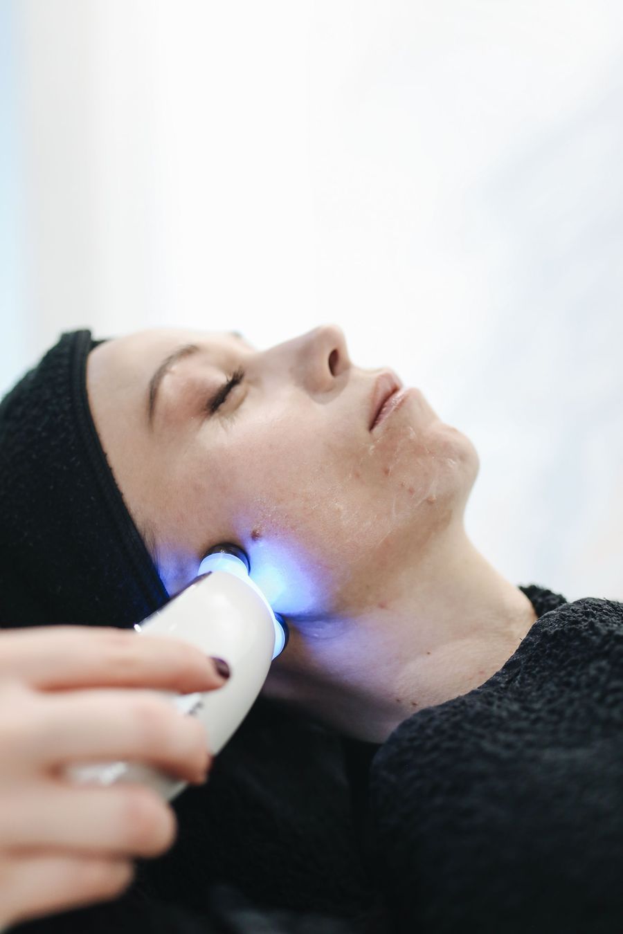 Tratamiento facial con aparato de radiofrecuencia